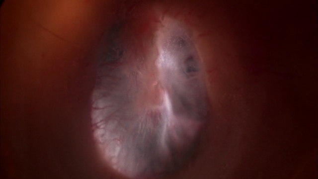 Video Reference N1: Nose, Skin, Flesh, Lip, Close-up, Ear, Mouth, Organ, Neck, Eye