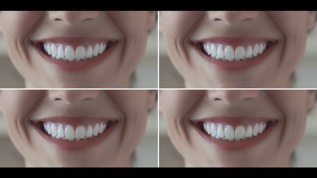 Video Reference N0: Tooth, Face, Smile, Skin, Jaw, Lip, Nose, Facial expression, Mouth, Chin