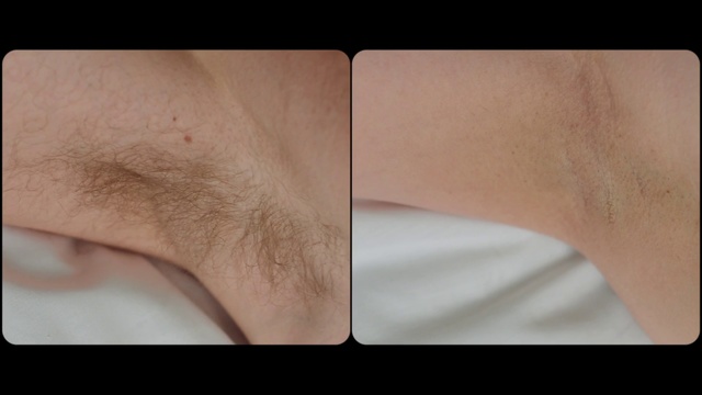 Video Reference N0: Skin, Eyebrow, Nose, Joint, Arm, Close-up, Neck, Hand, Flesh, Knee
