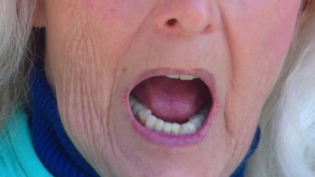 Video Reference N4: Tooth, Face, Tongue, Facial expression, Lip, Skin, Mouth, Nose, Chin, Close-up