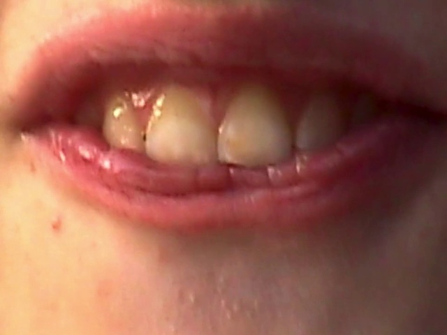 Video Reference N0: Tooth, Lip, Skin, Mouth, Cheek, Jaw, Close-up, Organ, Chin, Tongue